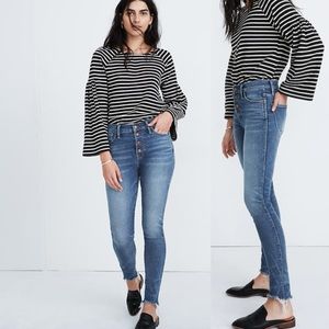 Madewell 10” High Riser Skinny Skinny Jeans